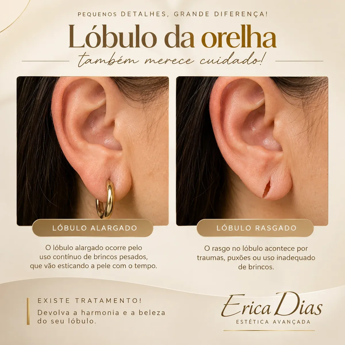 Estética Erica Dias — foto 6